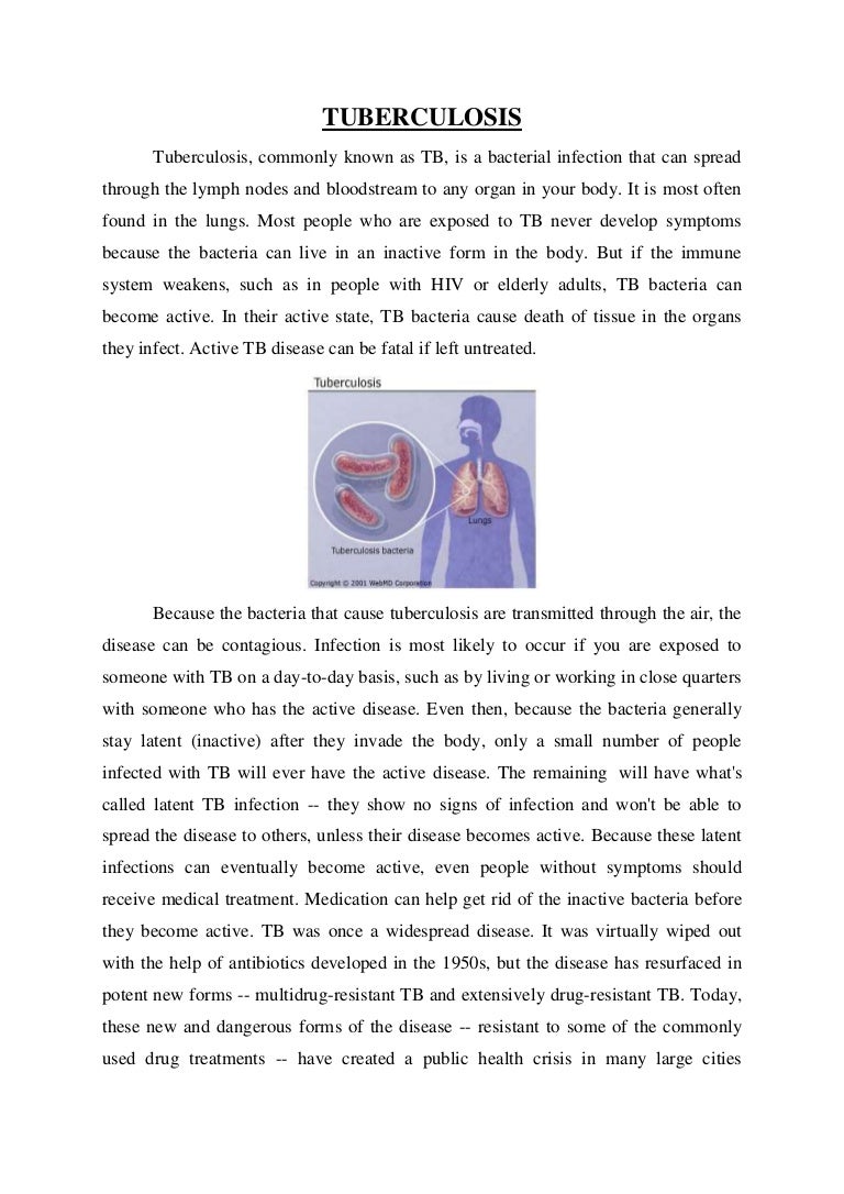 How tuberculosis is transmitted 25 How tuberculosis is transmitted 36